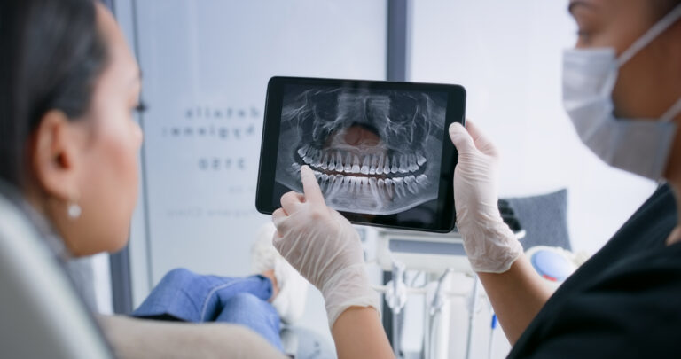 Dental Fillings 101: Everything You Need to Know Before Your Appointment